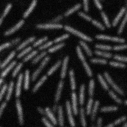 Close-up image of Pseudomonas aeruginosa (rod-shaped bacterium)