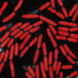 Overlay of masks on original image using the prompt "identify rod-shaped microorganisms"